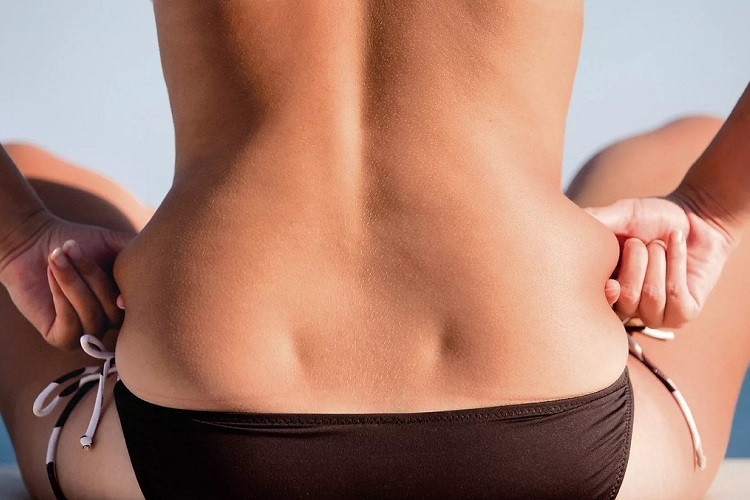 Why do fats accumulate at the sides