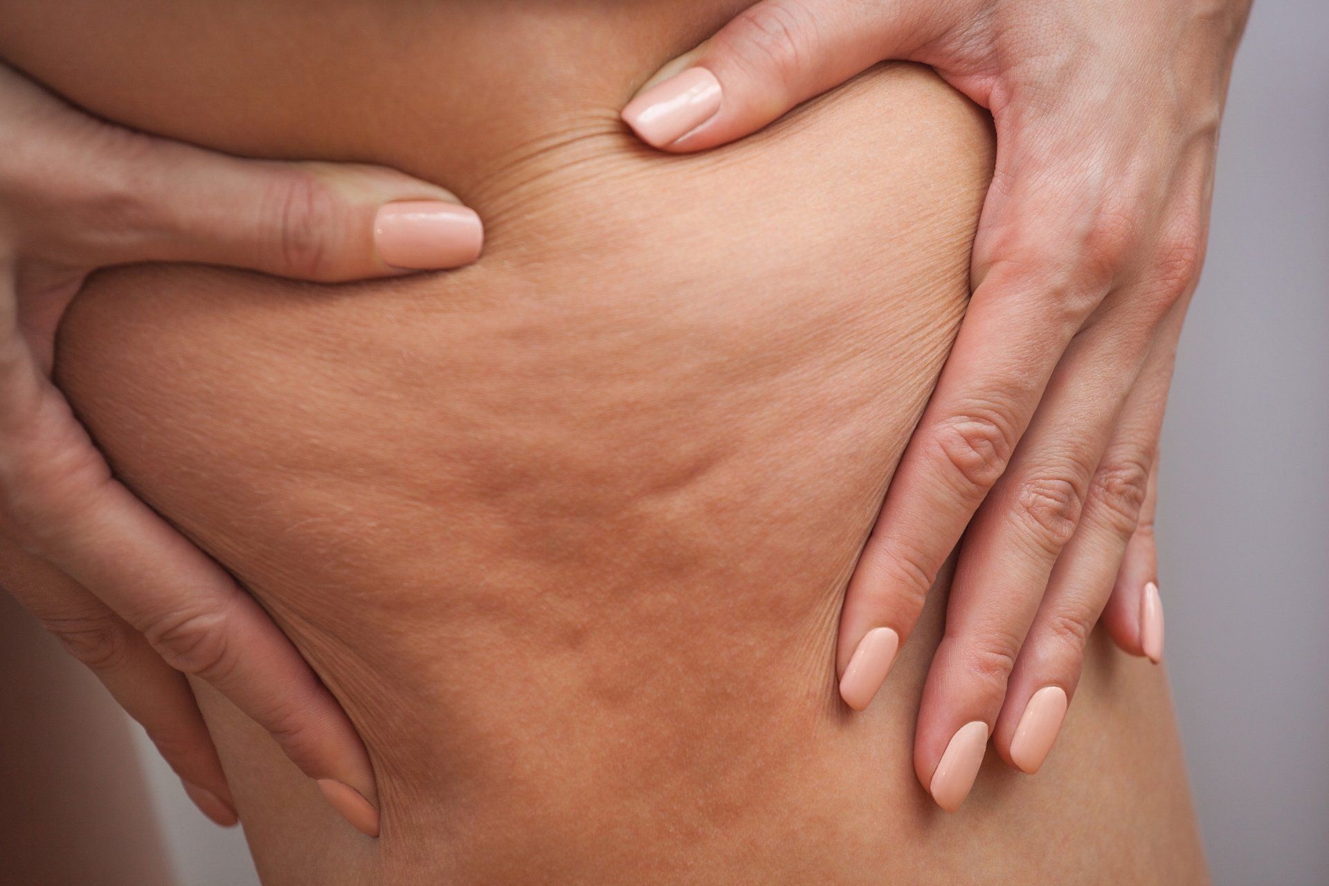 How To Get Rid Of Back Leg Cellulite
